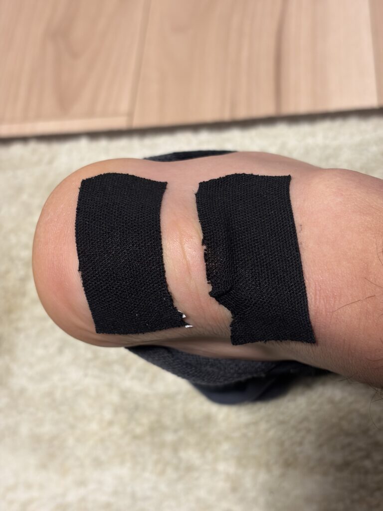 私の左足にテーピングをつけ患部の周囲を土手のように守っている画像